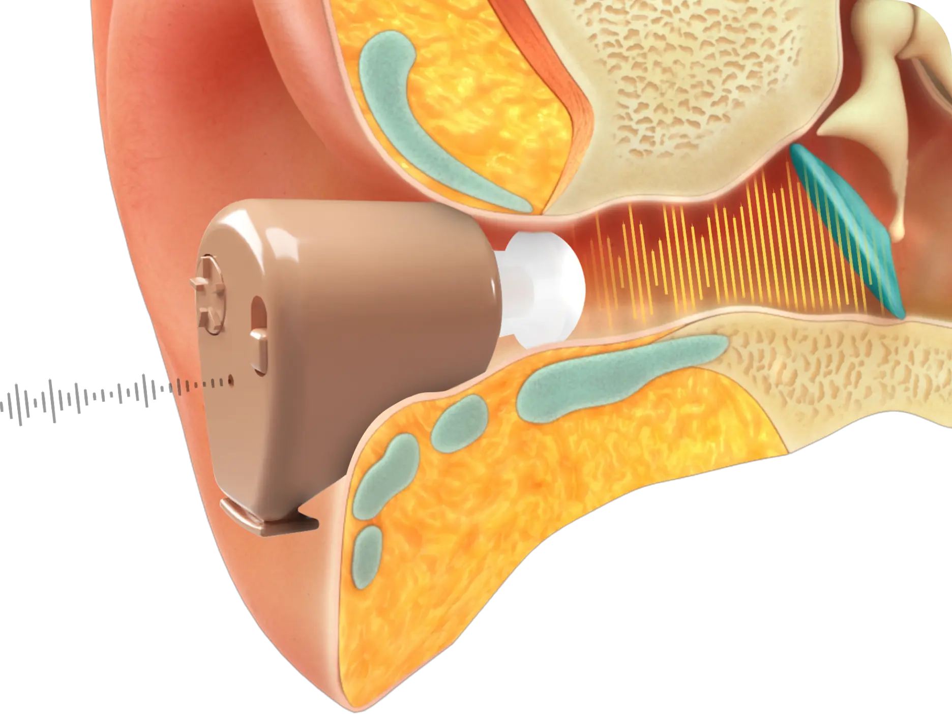 PureSound Pulse